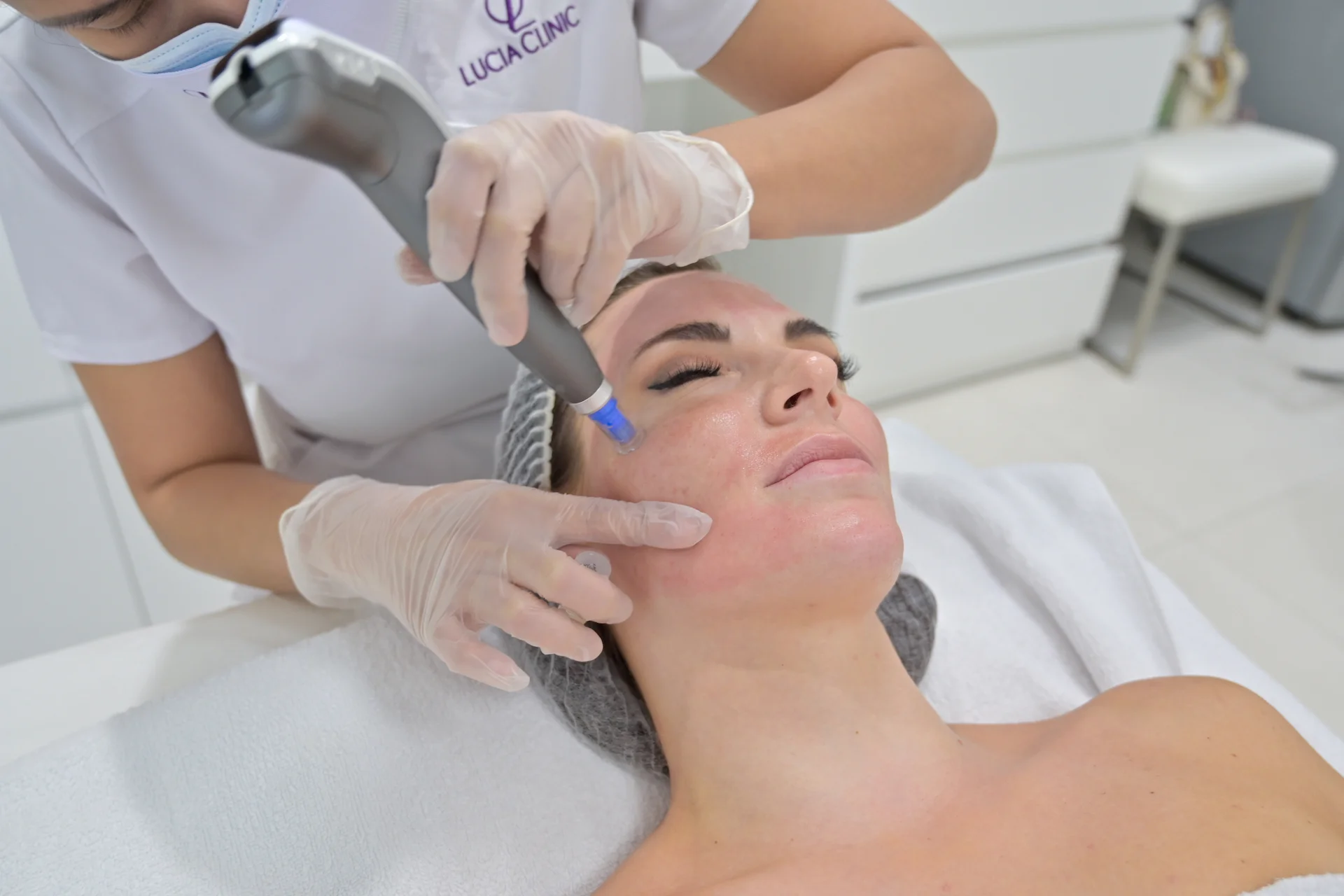 Microneedling Treatment