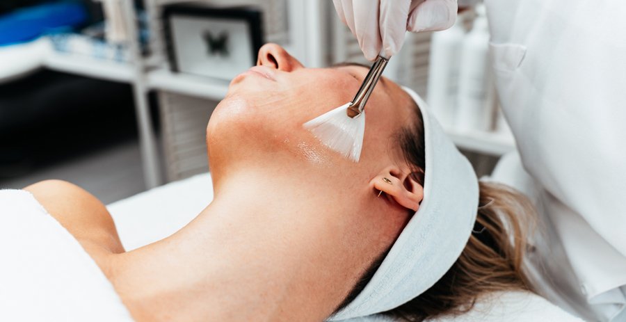 What is chemcial peel